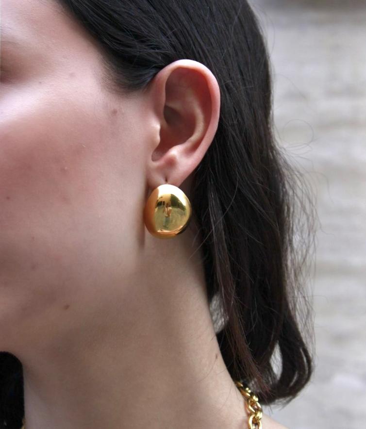 Aretes